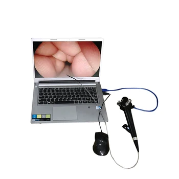 Портативный уретероскоп LTEG29 USB, Электронный видеобронхоскоп, Гибкий ЛОР-эндоскоп